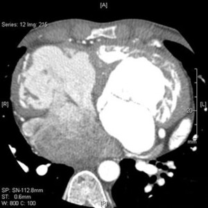 ctscan2-300×300